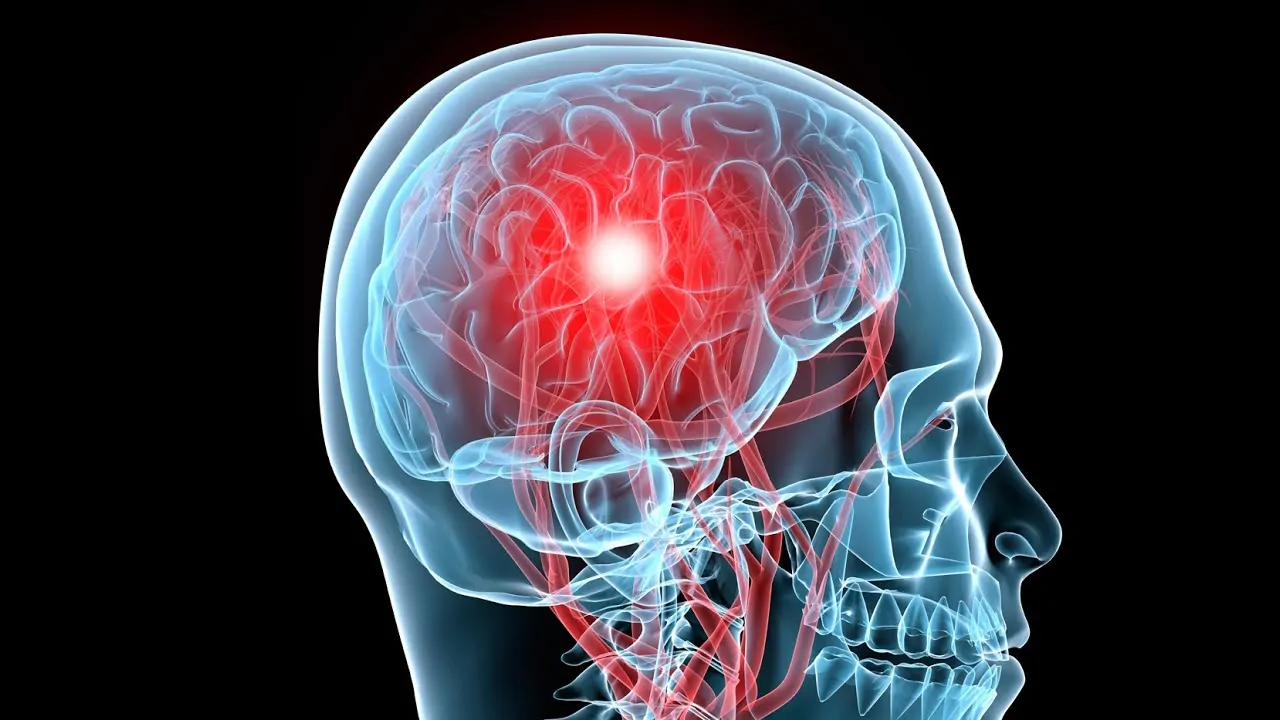 brain injury scan test results photo